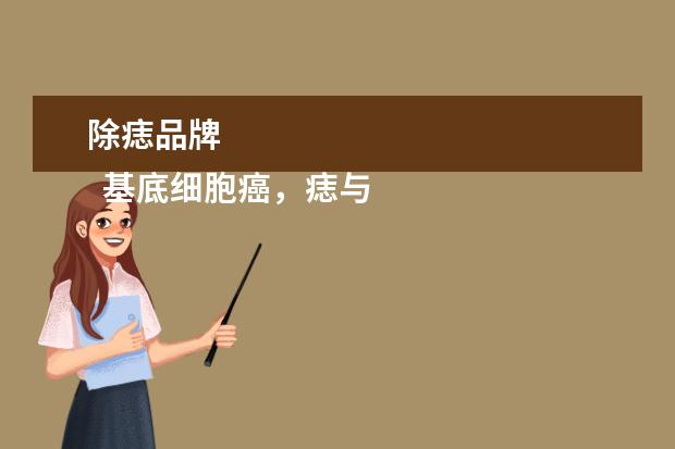除痣品牌 
  基底细胞癌，痣与黑色素瘤